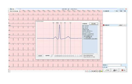 心電信息管理軟件ecgnet01華清心儀